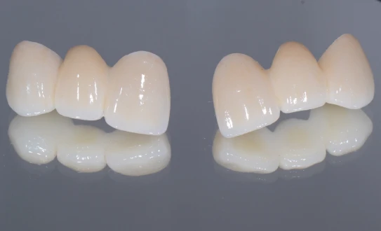 Porcelain Fused Zirconia