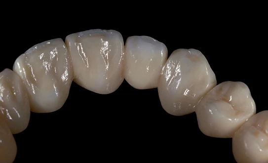 Zirconia Monolithic